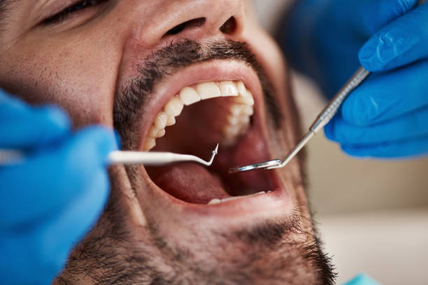 Fast & Reliable Emergency Dental Services in VA